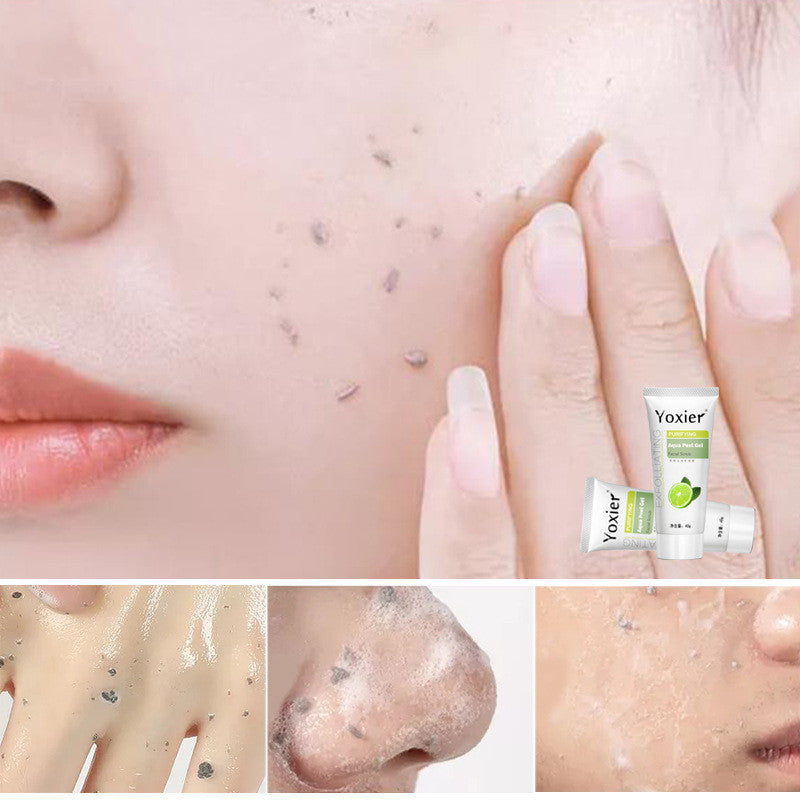 Peeling-Gesichtspeeling, Peeling-Gel, feuchtigkeitsspendend