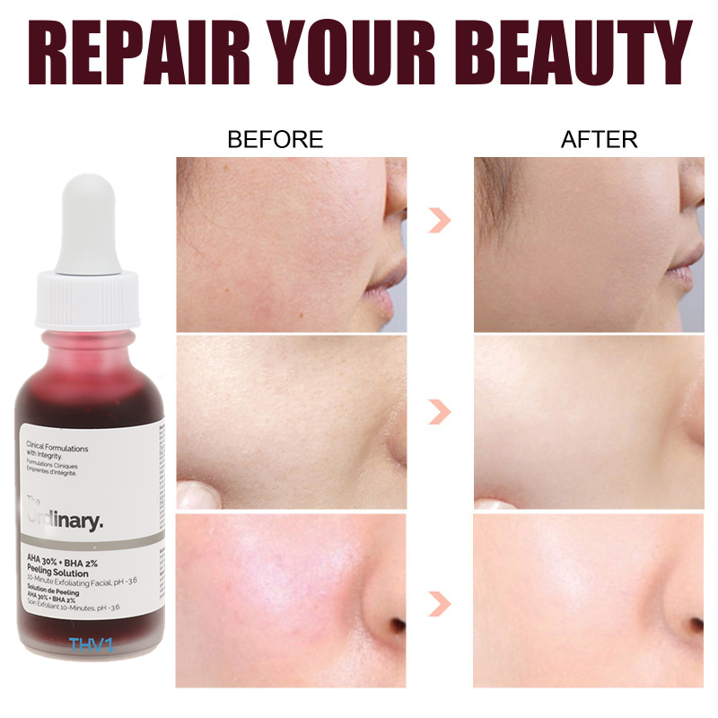 Ordinary Peeling Solution AHA 30% + BHA 2%